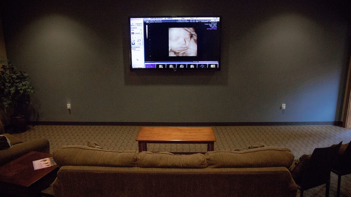 About 3D Keepsake Imaging